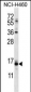 DSCR1L1 Antibody (N-term)
